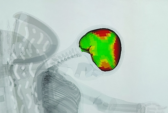 Zatížení mozku při nárazu